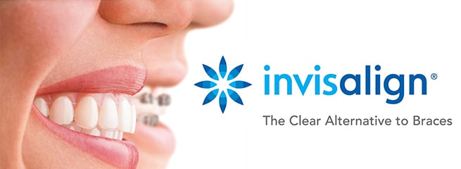 invisalign clear braces red bank nj