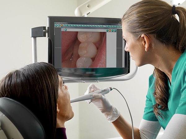 intra oral camera